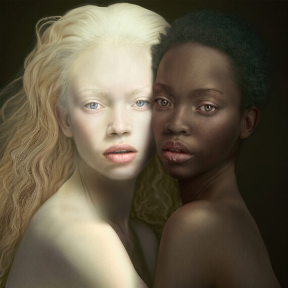 portrait of african albinism by cheraine collette