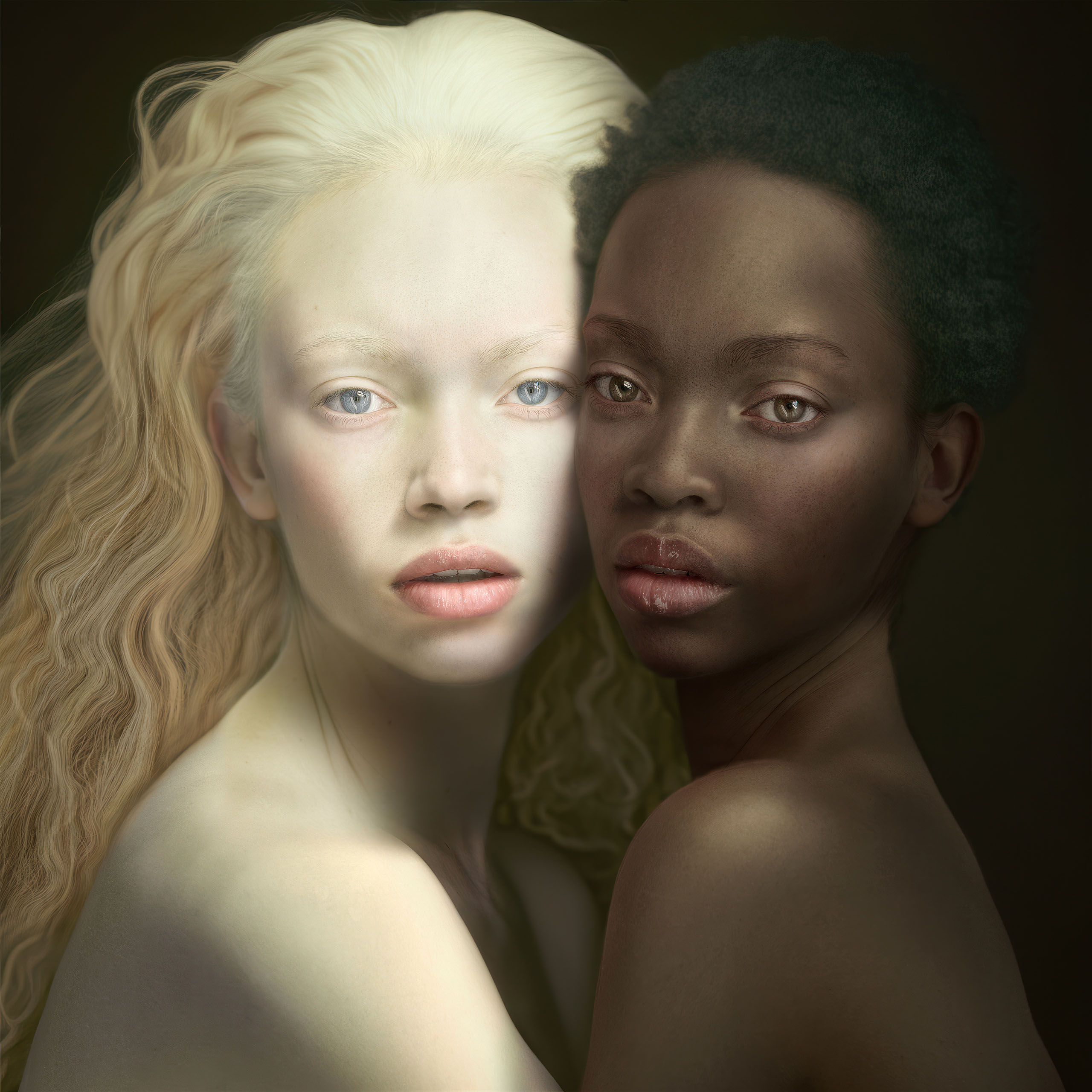 african albinism portrait