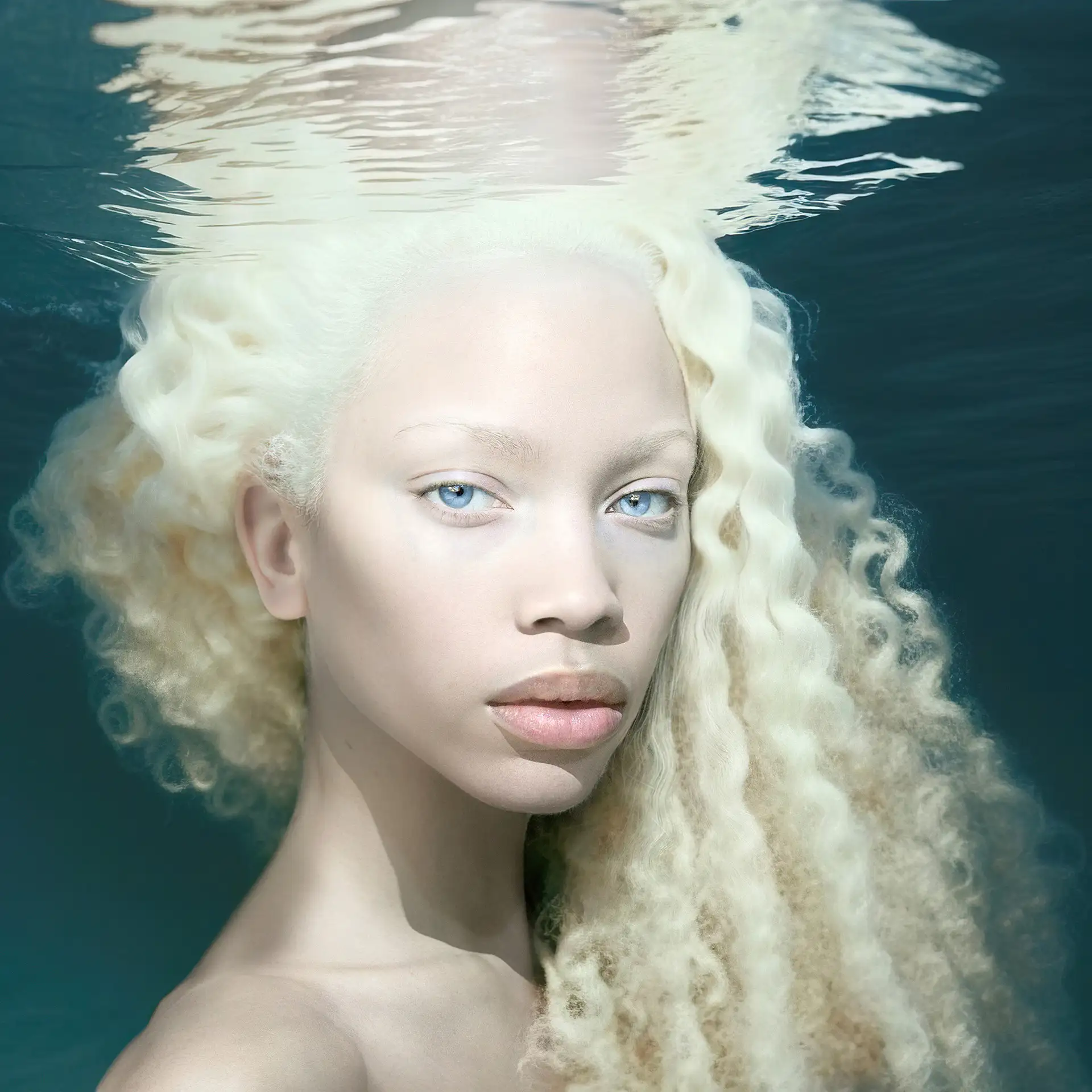 african albinism portrait